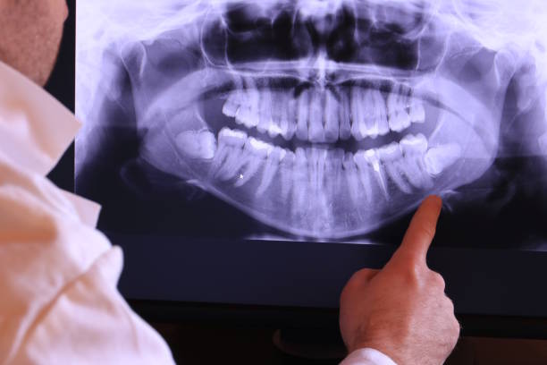 Best Emergency Dental Care for Broken or Chipped Teeth in Westfield, NJ