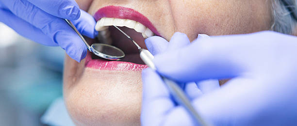 Best Emergency Root Canal Treatment in Westfield, NJ
